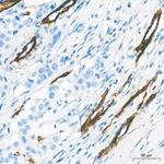 NG2 Antibody in Immunohistochemistry (Paraffin) (IHC (P))
