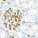 NG2 Antibody in Immunohistochemistry (Paraffin) (IHC (P))