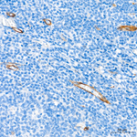 NG2 Antibody in Immunohistochemistry (Paraffin) (IHC (P))
