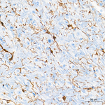 NG2 Antibody in Immunohistochemistry (Paraffin) (IHC (P))