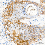 NG2 Antibody in Immunohistochemistry (Paraffin) (IHC (P))