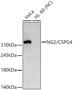 NG2 Antibody in Western Blot (WB)