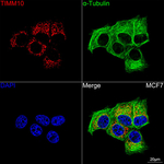 TIMM10 Antibody in Immunocytochemistry (ICC/IF)