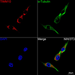 TIMM10 Recombinant Rabbit Monoclonal Antibody (9N5D1)