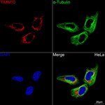 TIMM10 Antibody in Immunocytochemistry (ICC/IF)