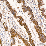 TIMM10 Antibody in Immunohistochemistry (Paraffin) (IHC (P))