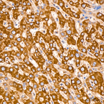TIMM10 Antibody in Immunohistochemistry (Paraffin) (IHC (P))