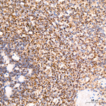 TIMM10 Antibody in Immunohistochemistry (Paraffin) (IHC (P))