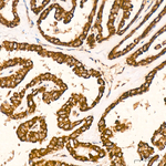TIMM10 Antibody in Immunohistochemistry (Paraffin) (IHC (P))