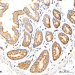TIMM10 Antibody in Immunohistochemistry (Paraffin) (IHC (P))