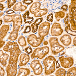 TIMM10 Antibody in Immunohistochemistry (Paraffin) (IHC (P))
