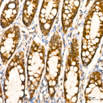 MAVS Antibody in Immunohistochemistry (Paraffin) (IHC (P))
