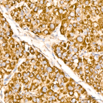 MAVS Antibody in Immunohistochemistry (Paraffin) (IHC (P))