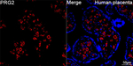 PRG2 Antibody in Immunohistochemistry (Paraffin) (IHC (P))