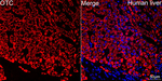 OTC Recombinant Rabbit Monoclonal Antibody (8Q8I2)