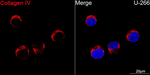 Collagen IV Recombinant Rabbit Monoclonal Antibody (1E7H5)