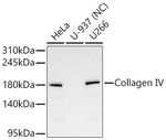 Collagen IV Antibody in Western Blot (WB)