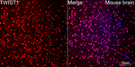 TWIST1 Antibody in Immunohistochemistry (Paraffin) (IHC (P))