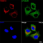 TIMM13 Antibody in Immunocytochemistry (ICC/IF)