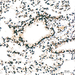 PTBP1 Antibody in Immunohistochemistry (Paraffin) (IHC (P))