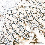 PTBP1 Antibody in Immunohistochemistry (Paraffin) (IHC (P))