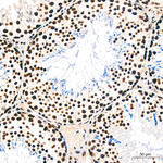 PTBP1 Antibody in Immunohistochemistry (Paraffin) (IHC (P))