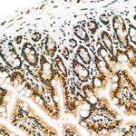 PTBP1 Antibody in Immunohistochemistry (Paraffin) (IHC (P))