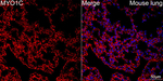 MYO1C Antibody in Immunohistochemistry (Paraffin) (IHC (P))