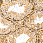 MYO1C Antibody in Immunohistochemistry (Paraffin) (IHC (P))