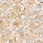 MYO1C Antibody in Immunohistochemistry (Paraffin) (IHC (P))