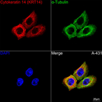 Cytokeratin 14 Antibody in Immunocytochemistry (ICC/IF)