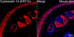 Cytokeratin 14 Antibody in Immunohistochemistry (Paraffin) (IHC (P))