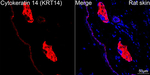 Cytokeratin 14 Antibody in Immunohistochemistry (Paraffin) (IHC (P))