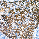 Cytokeratin 14 Antibody in Immunohistochemistry (Paraffin) (IHC (P))