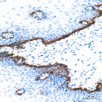 Cytokeratin 14 Antibody in Immunohistochemistry (Paraffin) (IHC (P))