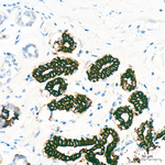 Cytokeratin 14 Antibody in Immunohistochemistry (Paraffin) (IHC (P))