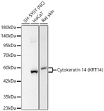 Cytokeratin 14 Antibody in Western Blot (WB)