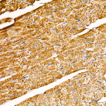 HADHB Antibody in Immunohistochemistry (Paraffin) (IHC (P))
