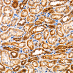 HADHB Antibody in Immunohistochemistry (Paraffin) (IHC (P))