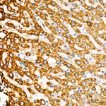 HADHB Antibody in Immunohistochemistry (Paraffin) (IHC (P))