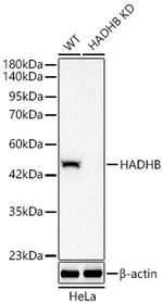 HADHB Antibody in Western Blot (WB)