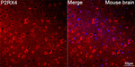P2X4 Antibody in Immunohistochemistry (Paraffin) (IHC (P))