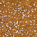 GLT-1 Antibody in Immunohistochemistry (Paraffin) (IHC (P))
