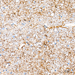 GLT-1 Antibody in Immunohistochemistry (Paraffin) (IHC (P))
