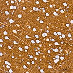 GLT-1 Antibody in Immunohistochemistry (Paraffin) (IHC (P))