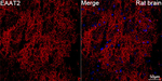GLT-1 Antibody in Immunohistochemistry (Paraffin) (IHC (P))