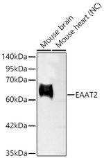 GLT-1 Antibody in Western Blot (WB)