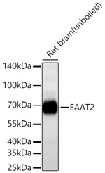 GLT-1 Antibody in Western Blot (WB)