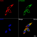 Alix Antibody in Immunocytochemistry (ICC/IF)