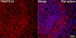 TRMT61A Antibody in Immunohistochemistry (Paraffin) (IHC (P))